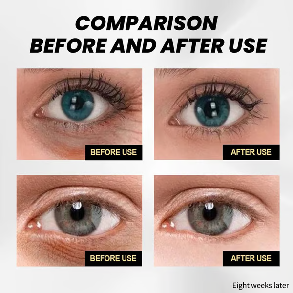 🎉Buy 1 Get 1 Free🎁 Instant Firming Eye Cream