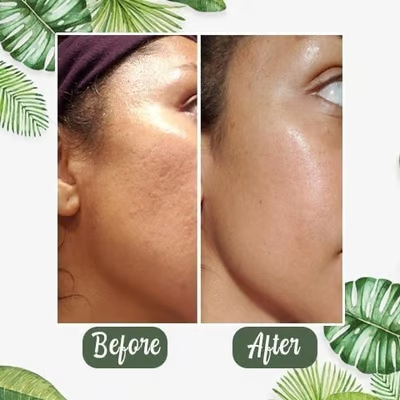 🍵 Deep Cleanse Green Tea Mask